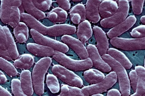 Louisiana Reports 5 Fatalities from Necrotizing Bacteria in Gulf Waters